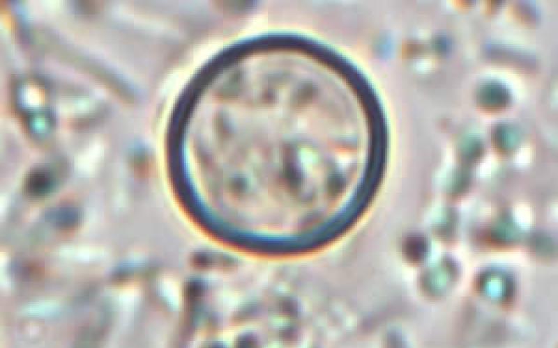 Outbreak of cyclosporiasis occurring in Michigan