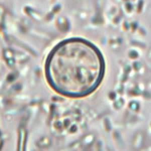 Outbreak of cyclosporiasis occurring in Michigan
