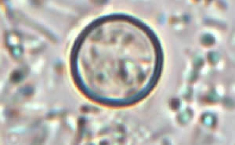 Outbreak of cyclosporiasis occurring in Michigan